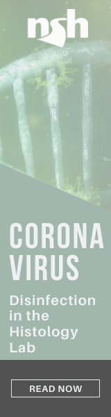 uKXnKSFQ6mVUP04D4IvV_Coronavirus